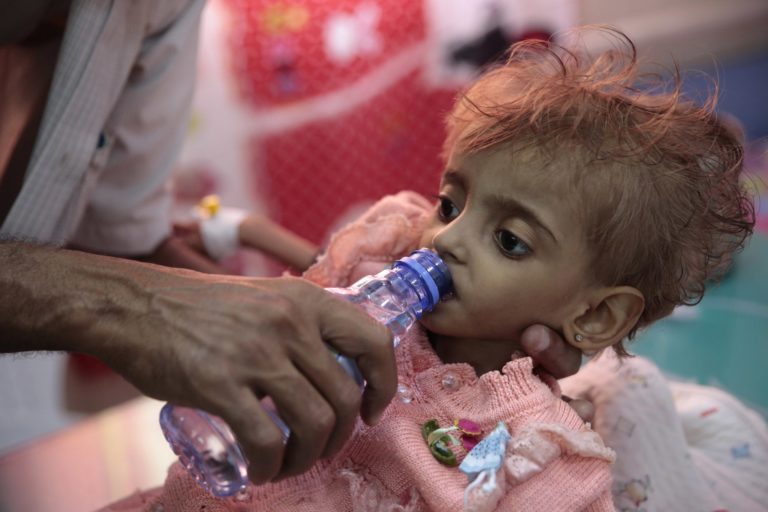 Aid group: 85,000 children may have died of hunger in Yemen