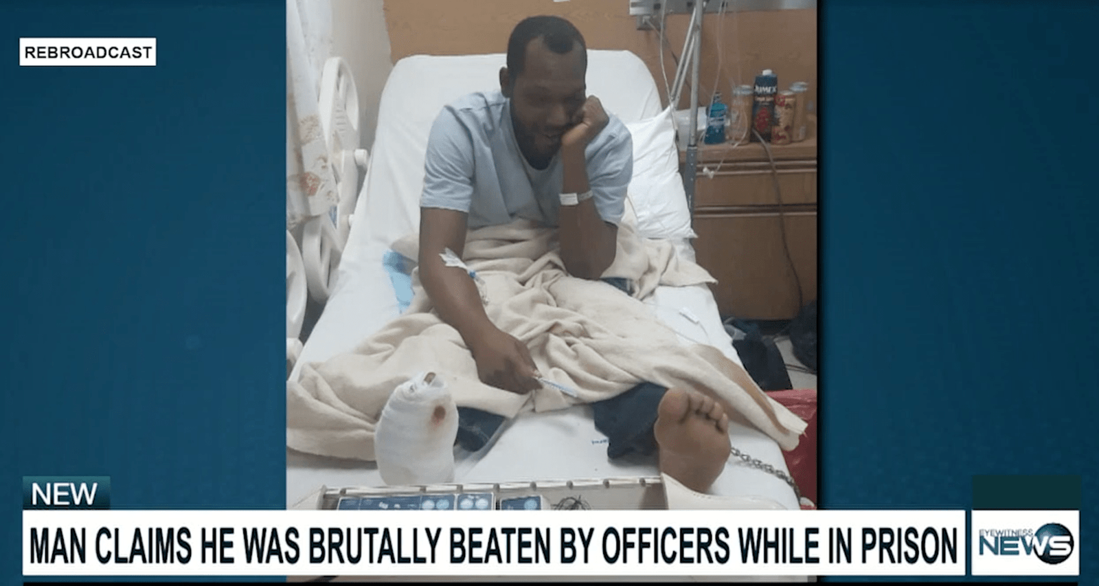 MAN CLAIMS HE WAS BRUTALLY BEATEN BY OFFICERS WHILE IN CUSTODY