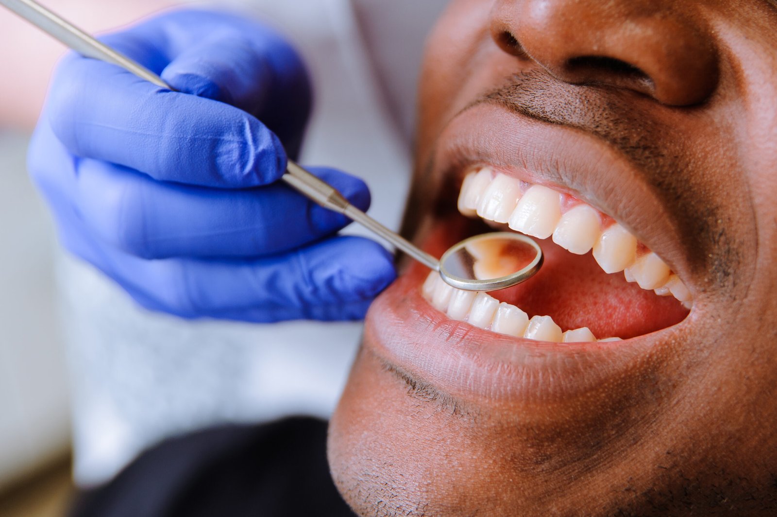 Dental scams on the rise