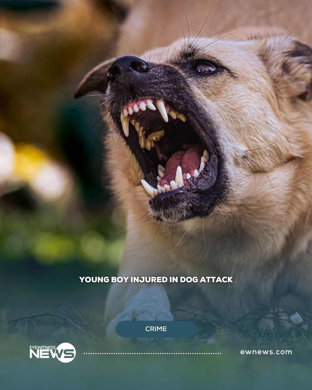 Young boy injured in dog attack